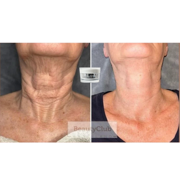 KrX Neck Lift Intensive Firming Cream