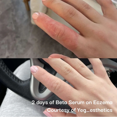 Neogenesis Beta-Glucan Serum
