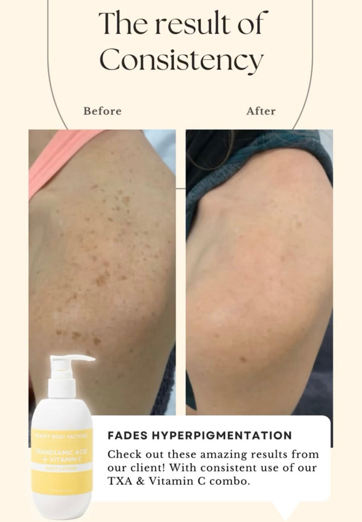 Body Factorie Tranexamic Acid + Vitamin C Body Lotion