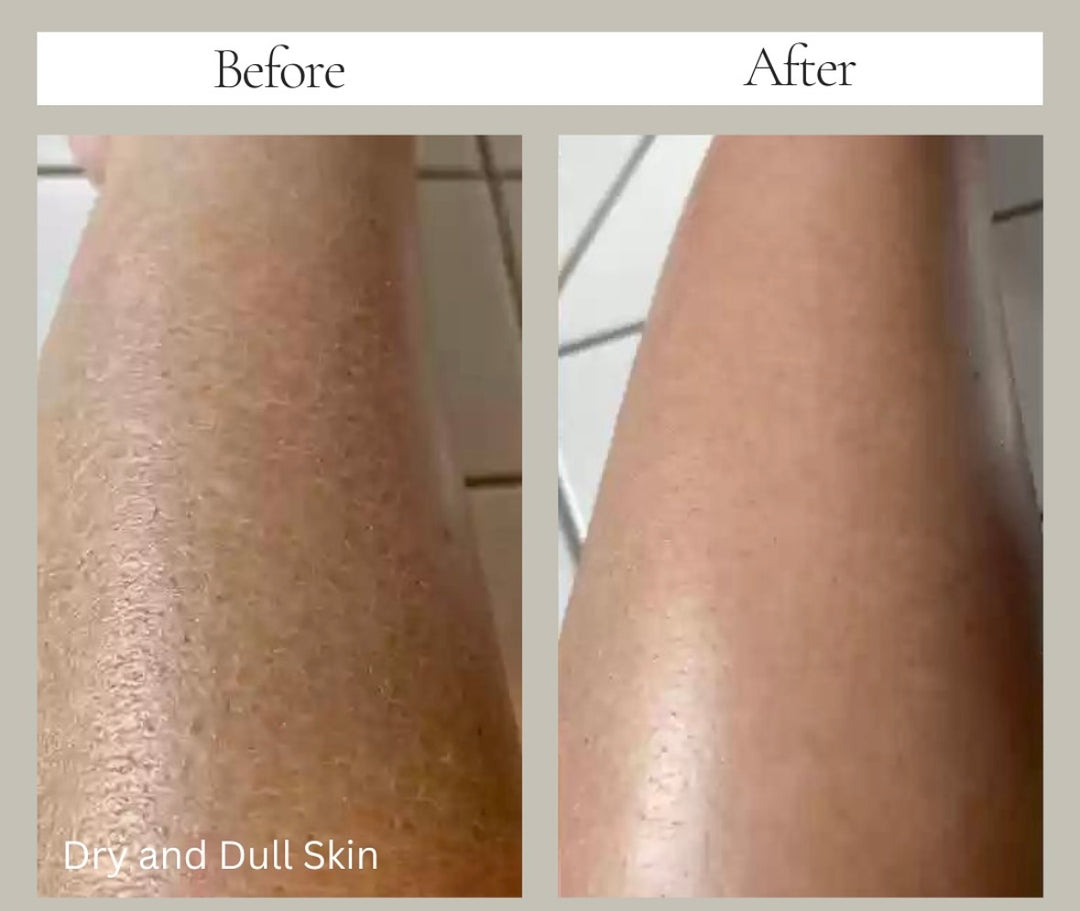 Body Factorie Tranexamic Acid + Vitamin C Body Lotion