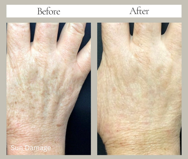 Body Factorie Tranexamic Acid + Vitamin C Body Lotion