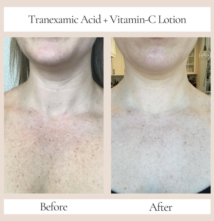Body Factorie Tranexamic Acid + Vitamin C Body Lotion
