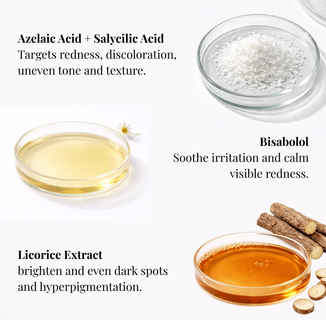 Halina André Azelaic Lotion